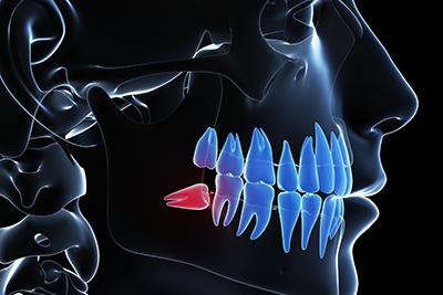 一般的に知られている親知らずの抜歯以外にも様々対応します