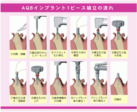 カウンセリングを通じて患者様の要望や不安を丁寧に伺い、適切な治療計画の提案が行われています