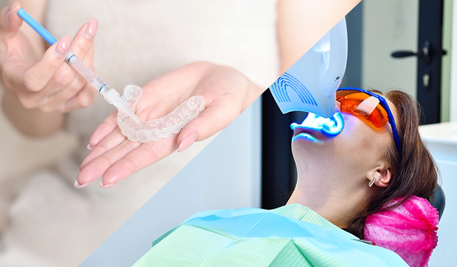 歯の色や形を整え口元全体を見ています