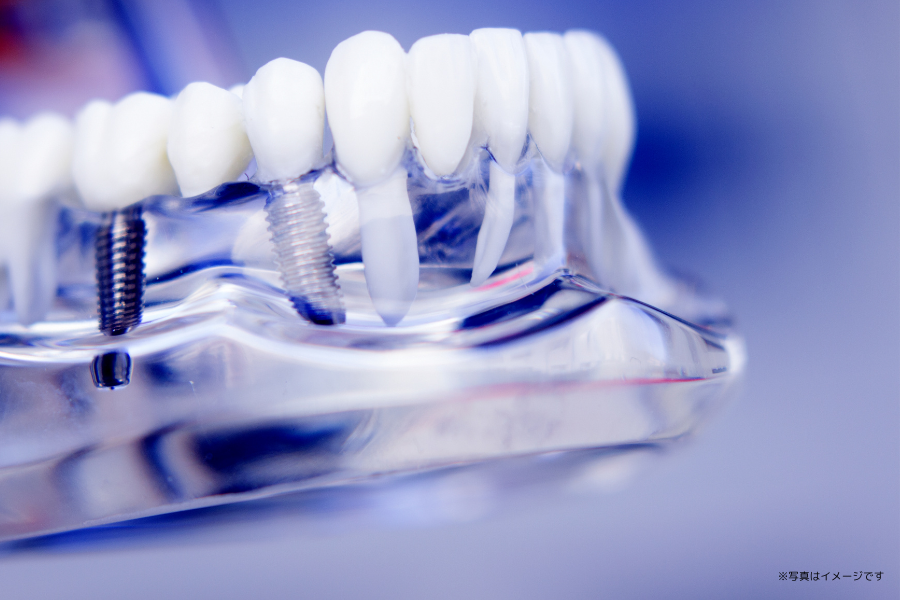 患者様の口腔内の状態や生活スタイルに合わせた治療計画を立て、無理のない治療を心がけています