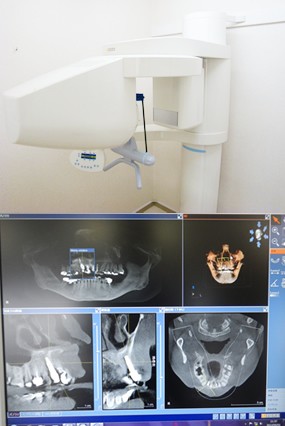 3D診断を用いたインプラント治療に特化しているCT設備