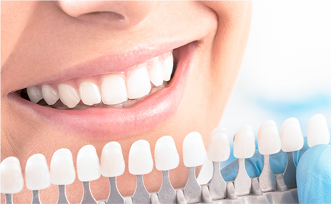 自然で美しい歯を実現できるよう心がけています