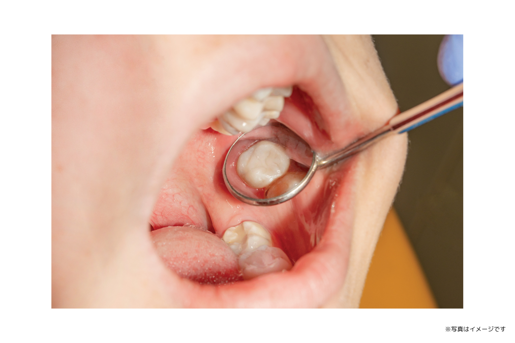 【新須屋駅 徒歩9分】6,000件以上の豊富なインプラント症例実績で健やかな食生活を支える新地ハロー歯科診療所