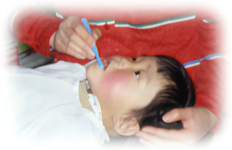 正しいブラッシングの継続が重要