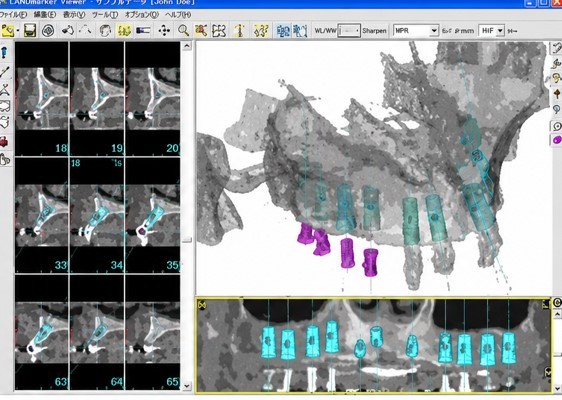 ３D解析を活用した診断