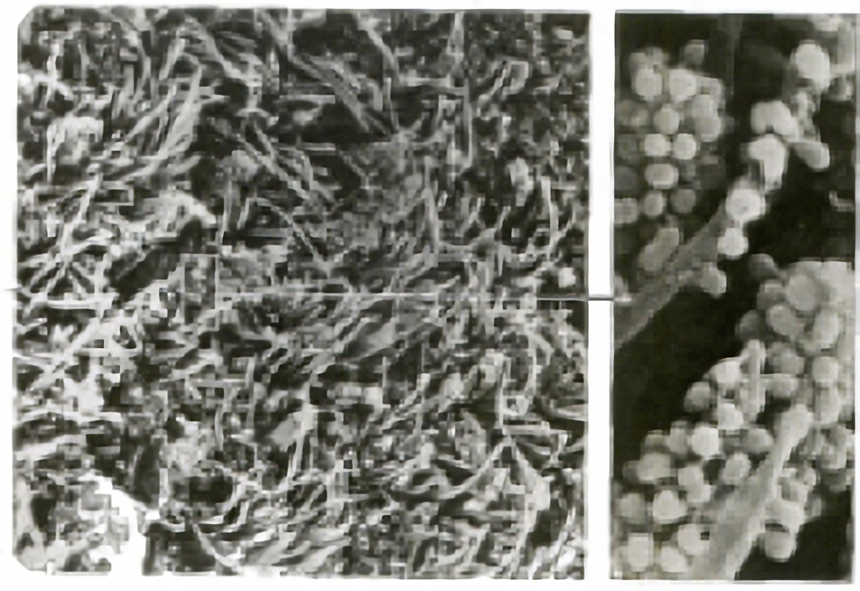 口腔内の環境を整えましょう