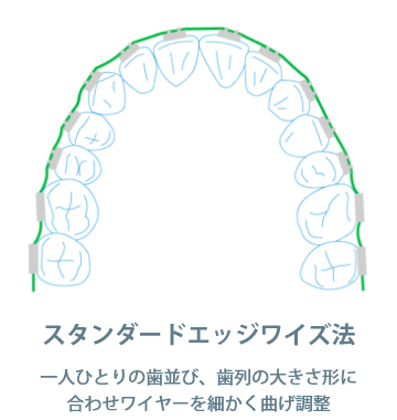 スタンダードエッジワイズ法に対応