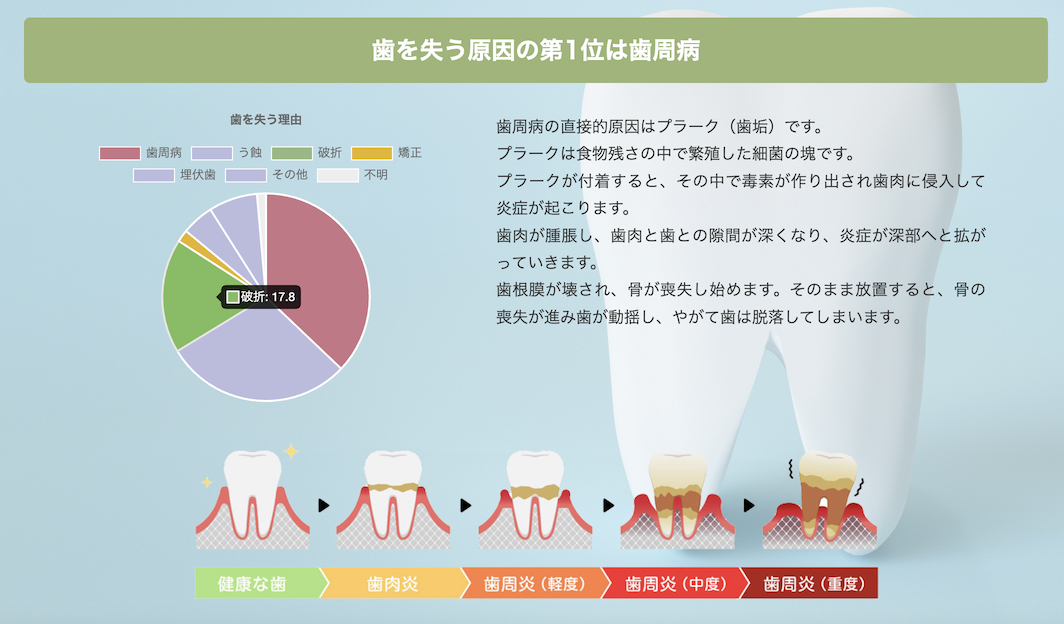 日本の歯科医院のわずか3％しか導入していない顕微鏡を用いた精密な歯周病治療を実施しています