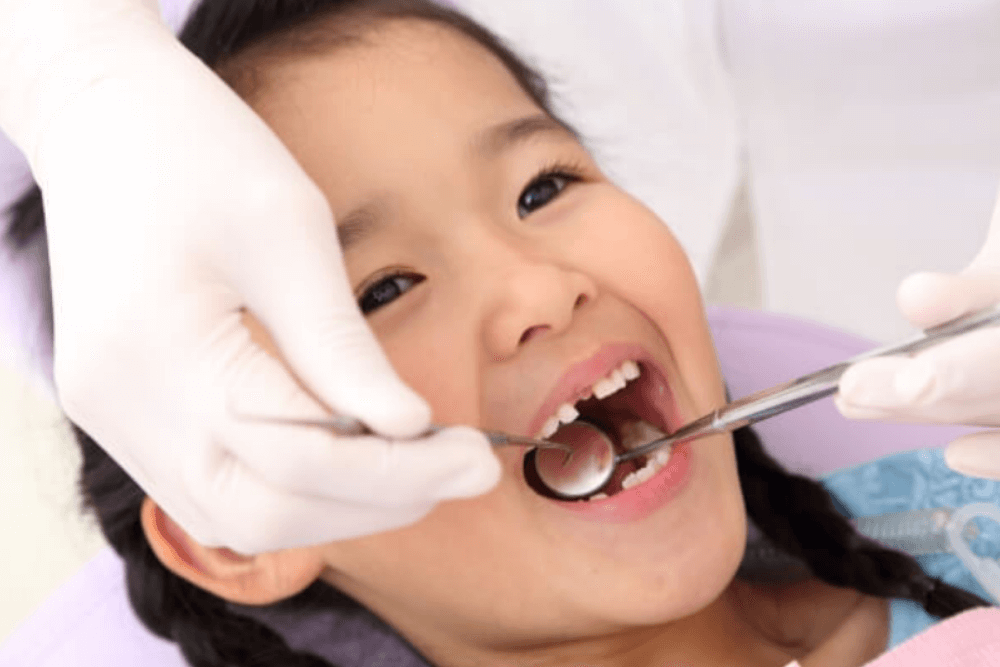 定期検診後はフッ素塗布を行います