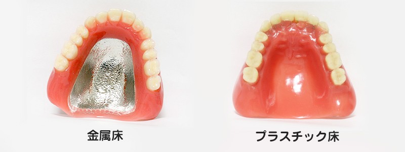 最適な入れ歯をご提案します