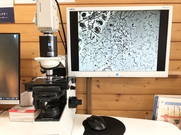 位相差顕微鏡でお口の中を確認