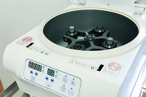 インプラント治療や歯周外科処置などに応用される遠心分離機です