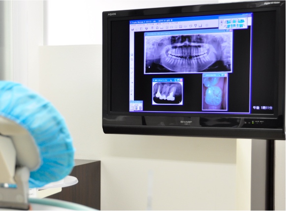 32インチのモニターにより口腔内をわかりやすく説明します