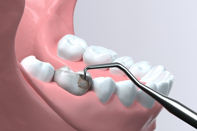 写真はイメージです