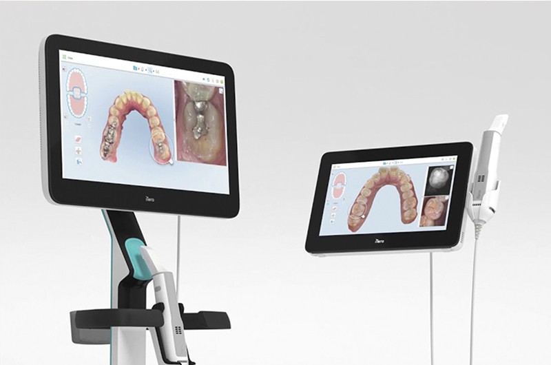 iTeroという口腔内スキャナーで精密な歯型データを採取します