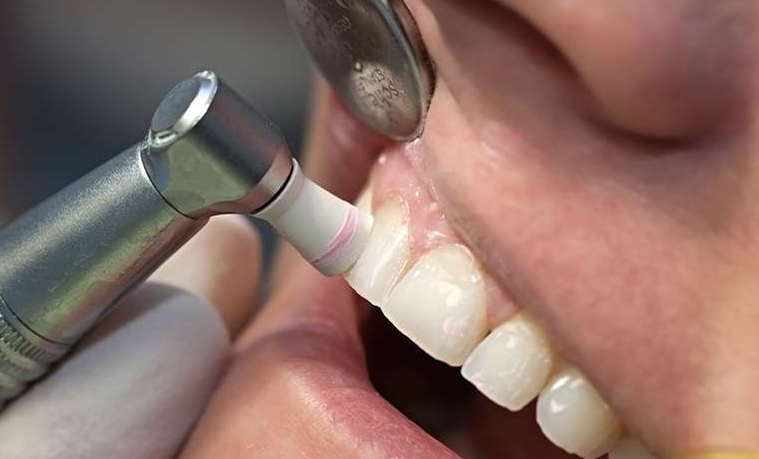 科学的根拠に基づく予防処置と定期ケアで全身健康につなげる診療