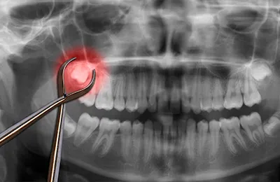 親知らずも顎の悩みもお任せ