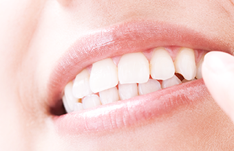 ご自身の歯を残せる可能性が高まります