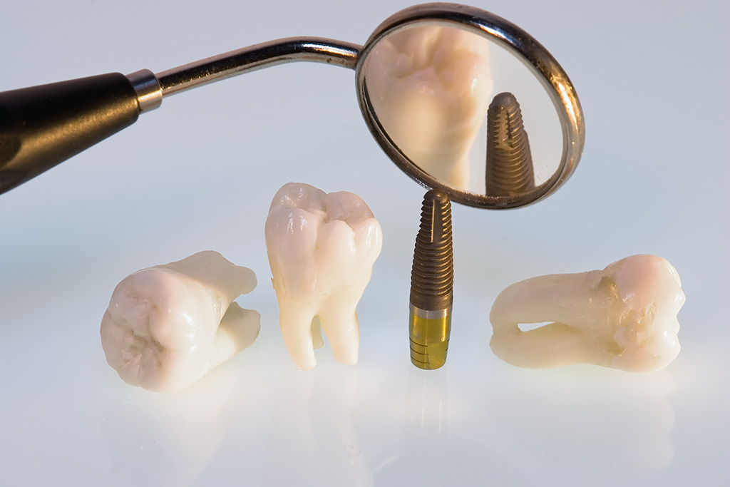 安心してお任せください