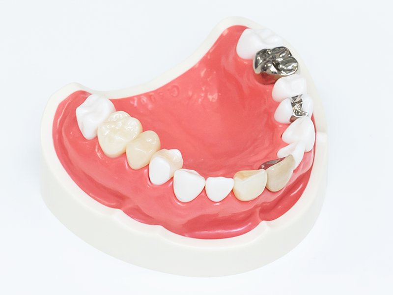 多様なニーズに応える審美的な治療を提供します