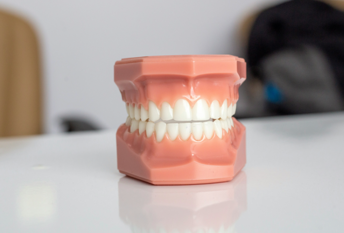 健康な歯を守るための継続的なケア