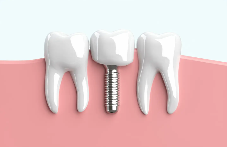 二人三脚で予防歯科を行っていきましょう