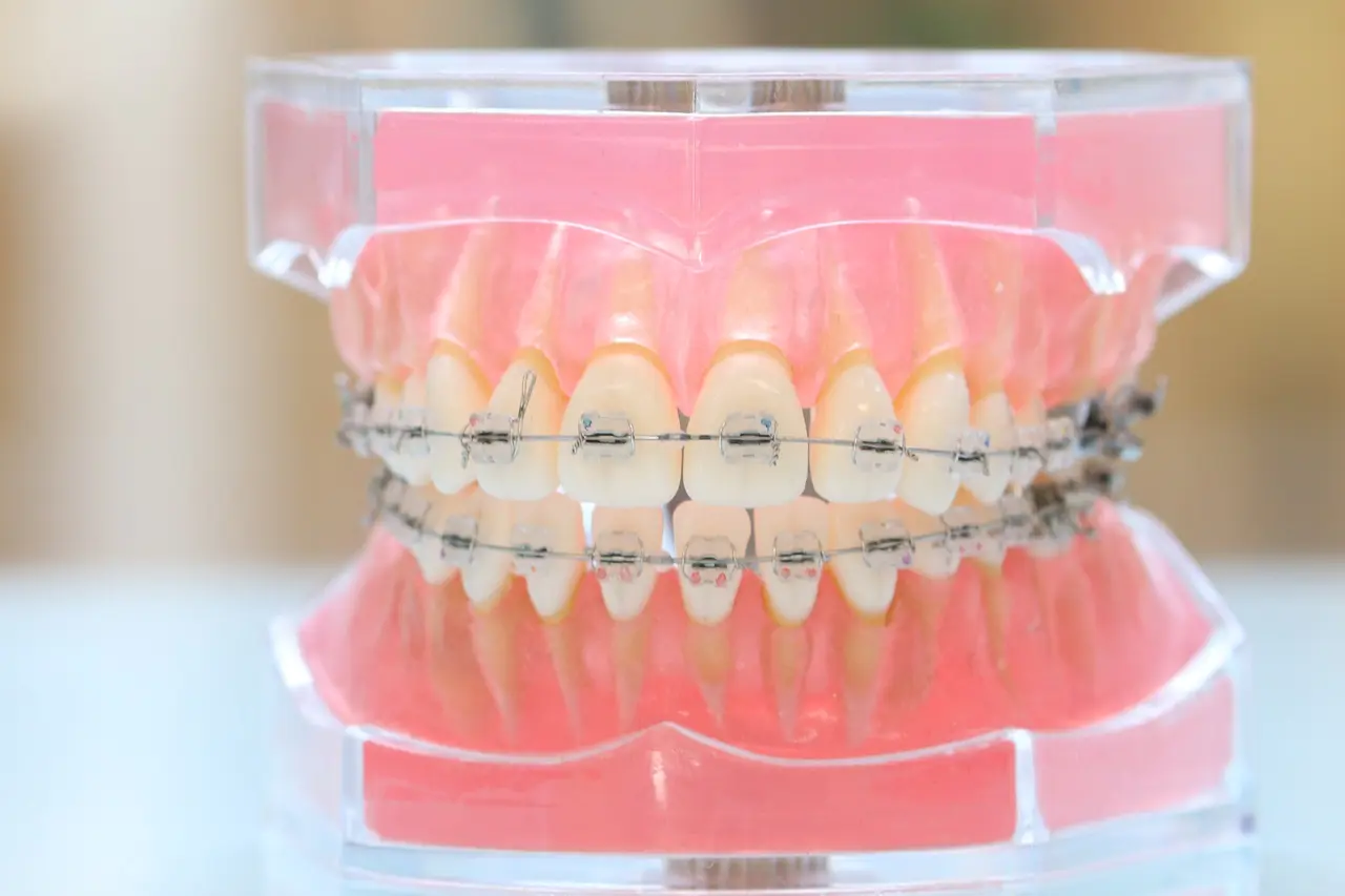 矯正認定医が対応するから、治療も安心して任せられる