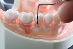 治療後は再発を防ぐ継続的なサポートを行っています