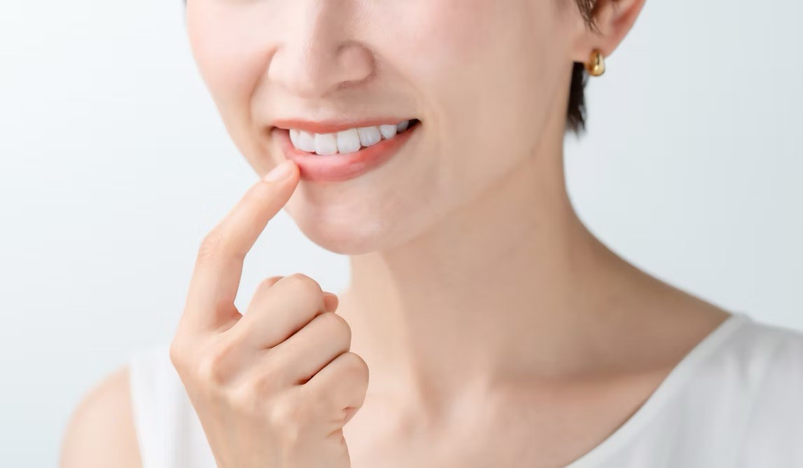 ホームホワイトニングに対応しています