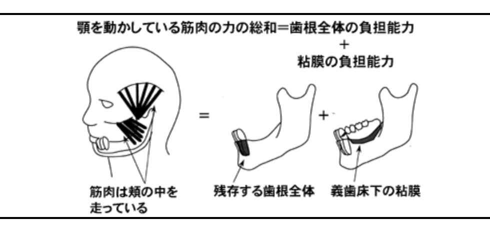 良い義歯のためには、力関係を考慮することが大切です