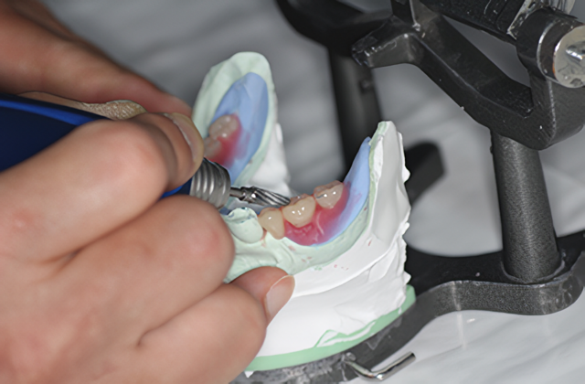 院長が自ら患者様にあった被せ物・詰め物を製作いたします