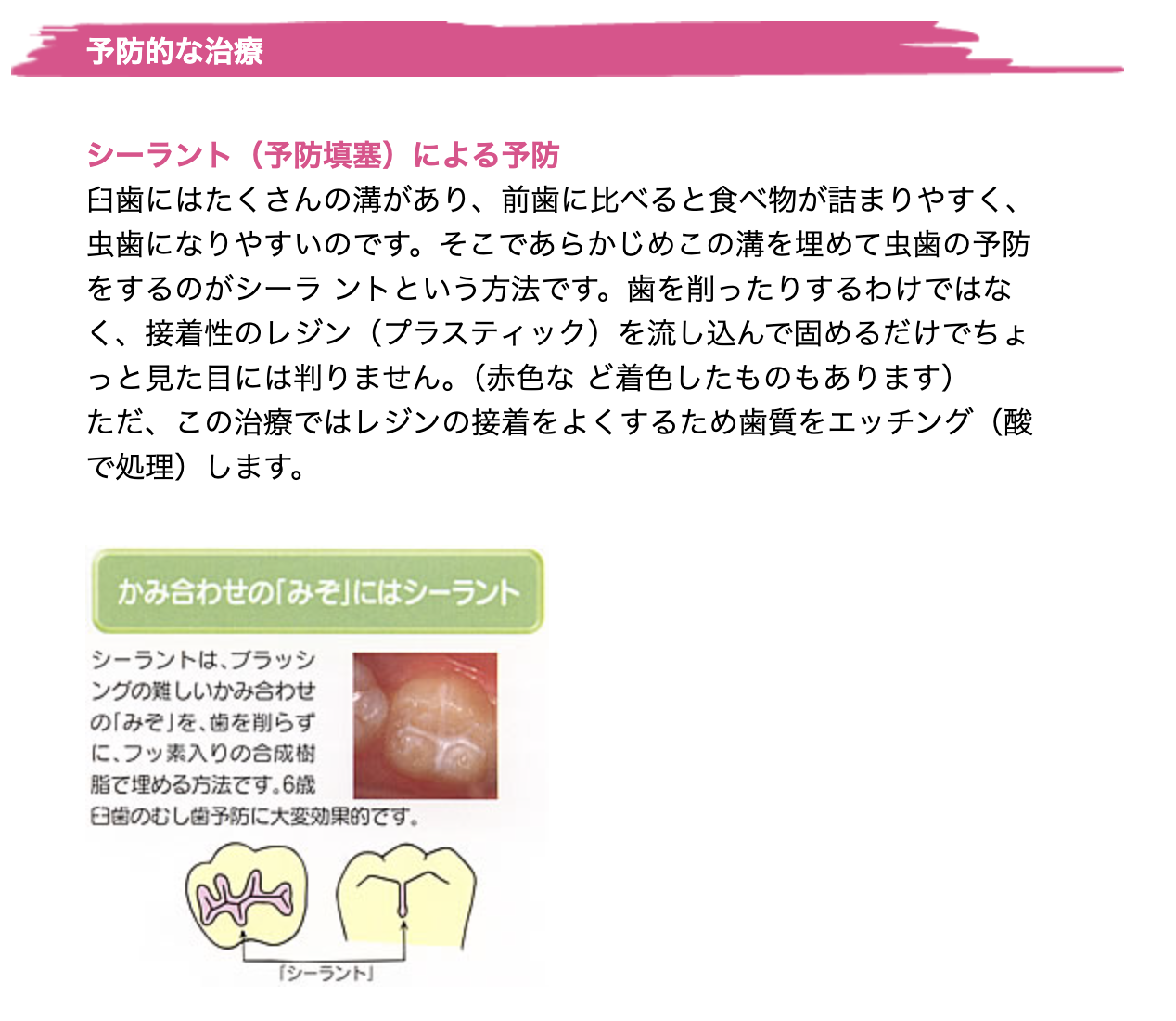 お子様の歯を虫歯から守るための予防的な処置を行い、健康な歯の成長をサポートしています