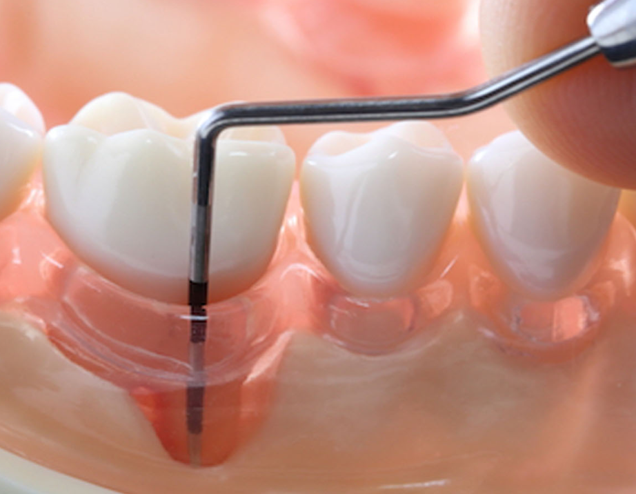 歯周病治療は全て歯周病専門医が行います