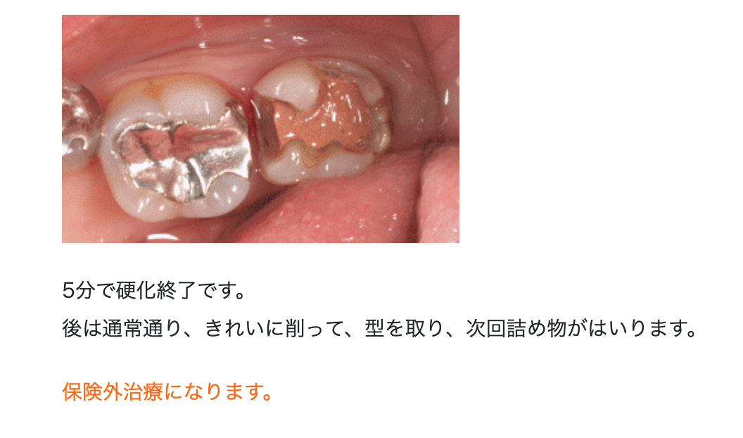 ドックスベストセメント治療を採用し、虫歯を無菌化することで、神経を残せる可能性を高めています