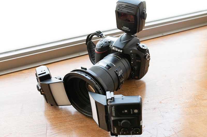 カメラを活用し口内環境をすみずみまでチェックします