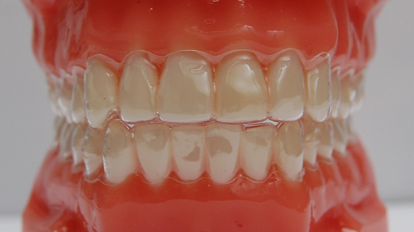 マウスピース矯正治療を提供