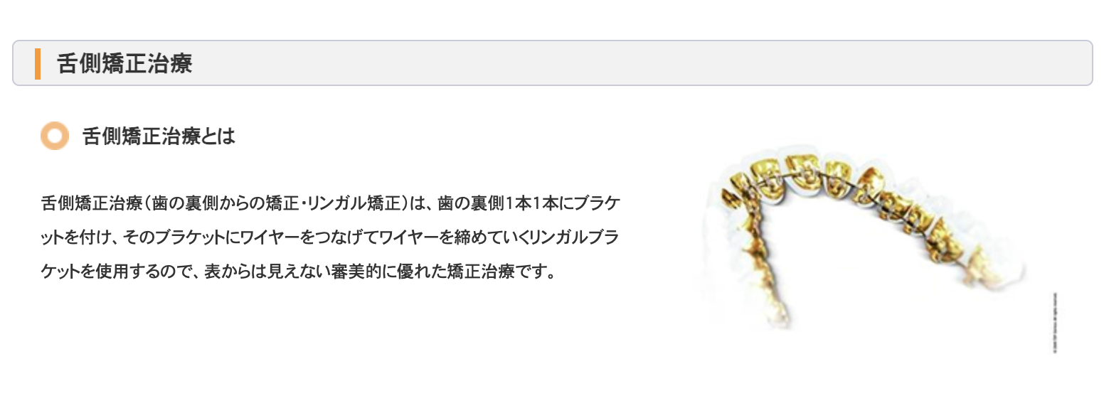 歯の裏側に矯正装置を装着する舌側矯正治療（リンガル矯正）を提供しています