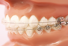 様々な方法があります