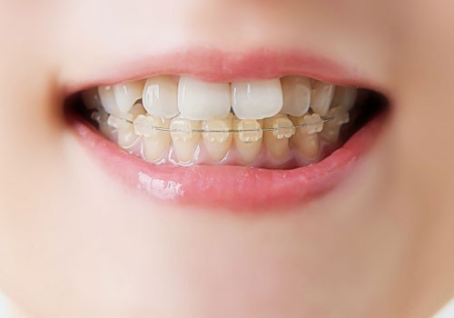 一人ひとりに寄り添いながら、機能面と審美面の両立を目指した矯正治療を提案しています。