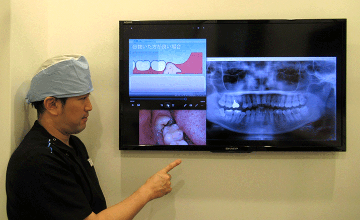 無理に抜くのではなく、保存すべきケースについては慎重に経過観察を行い、患者様の状態に最も適した治療法を提案しています
