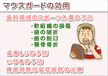 スポーツ時の安全性を高めるためのマウスガードの製作にも力を入れております