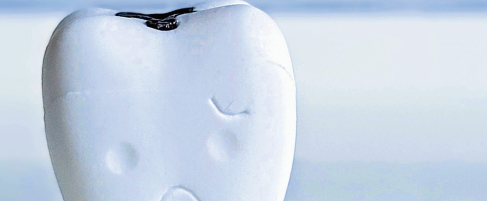 歯を守るためにできること