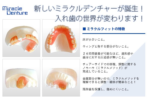 ミラクルデンチャー