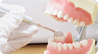 定期検診で虫歯予防