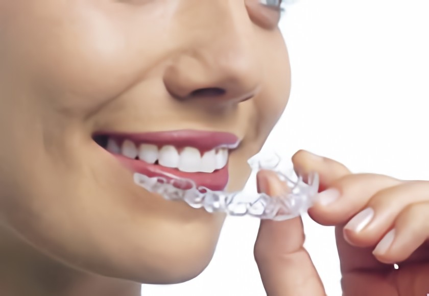 インビザラインを取り扱っています