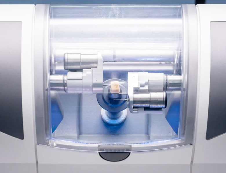 セレックシステム