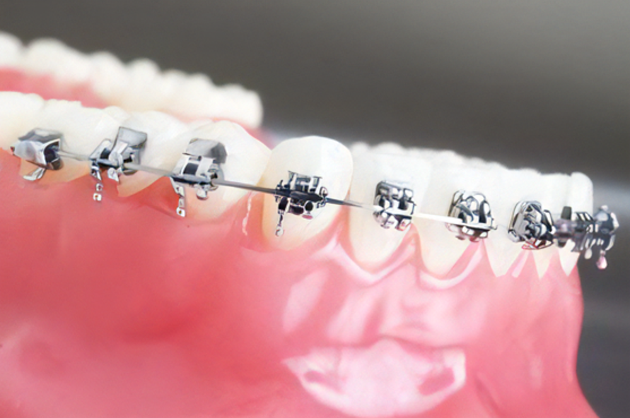 専門医による矯正歯科治療を提供