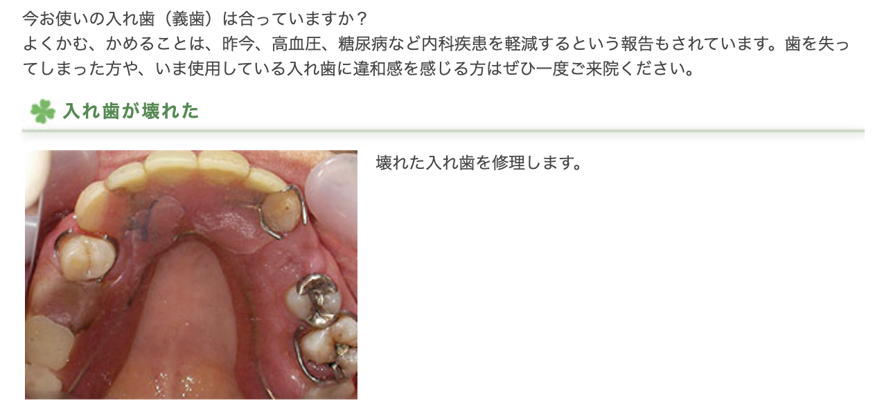 入れ歯に関するさまざまなお悩みに対応しています