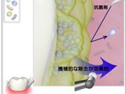 お口の健康を長く維持するための予防歯科に注力しています