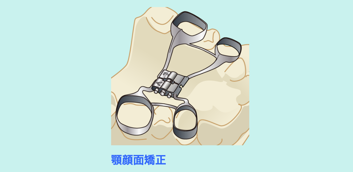 顎顔面矯正では、成長を利用しながら顎の発育を促し、自然な歯並びへと導くことを目指します